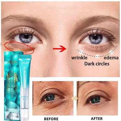 RevivaBright: Dark Circle & Eye Bag Reducing Cream